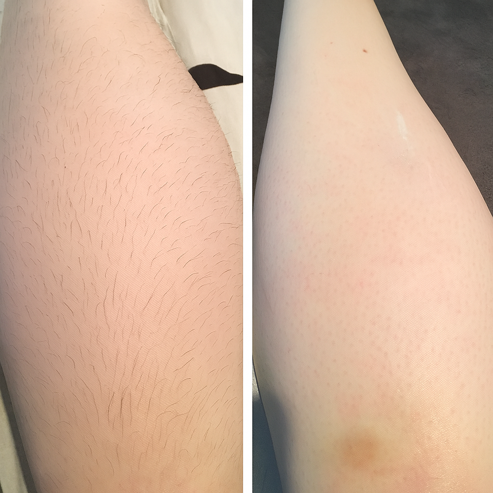 <h2>Loved by everyone, everywhere. Don't miss out.</h2>