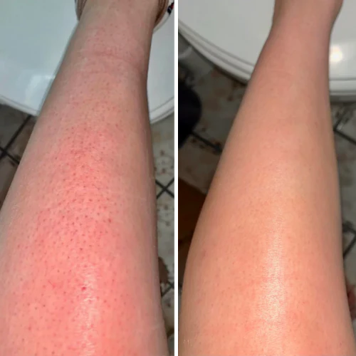 <h2>Loved by everyone, everywhere. Don't miss out.</h2>